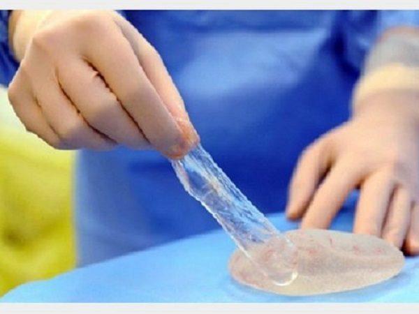 پروتز های مورد استفاده توسط جراحان پلاستیک قابل ردیابی است، بیماران نگران کیفیت نباشند