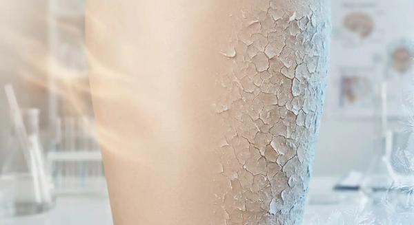 روش ها و ترفندهایی ساده برای درمان خشکی پوست