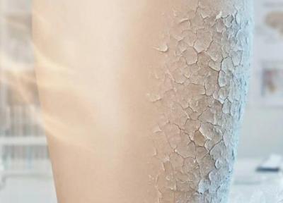 روش ها و ترفندهایی ساده برای درمان خشکی پوست